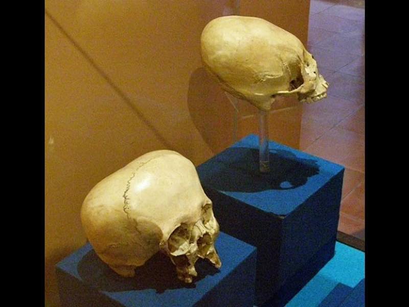 Ancient Elongated Skulls Of Mexico: See Them With Us In January 2018 
