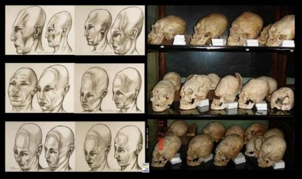 Elongated-skulls-museum-Romania