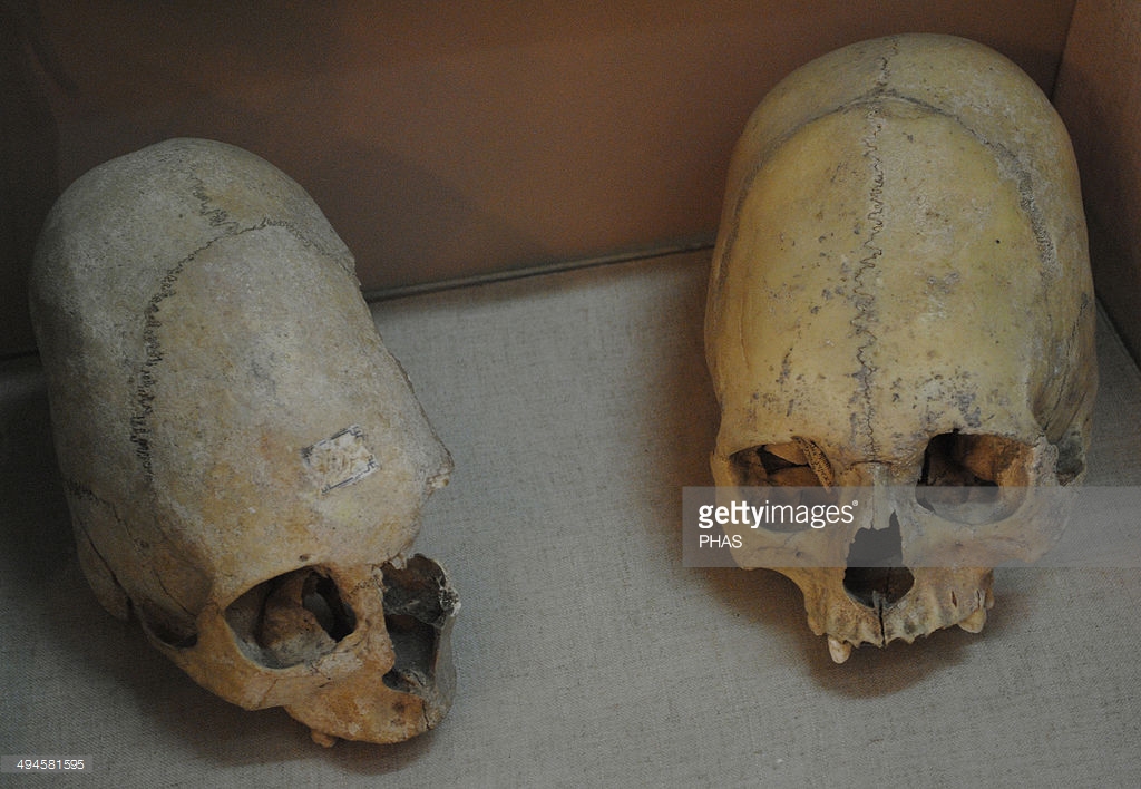 Sarmatians. Two deformed human skulls. Probably dated in the 3rd century BC. Kerch Historical and Archaeological Museum. Autonomous Republic of Crimea. Ukraine.