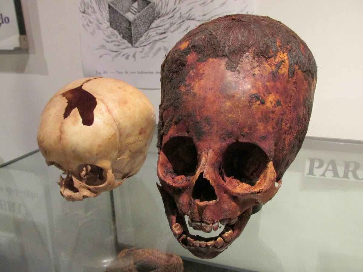 Unwrapping A 2000 Year Old Red Haired Elongated Baby Skull In Paracas Peru 