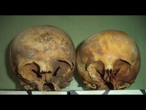 The Star Children Skulls Of Peru
