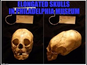 Enormous Peruvian Child's Elongated Skull In The Penn Museum