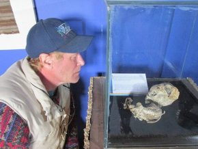 Two American Doctors Examine Elongated Skull "Mother And Baby Fetus" In Bolivia