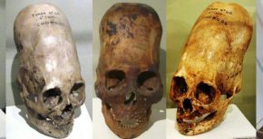 Elongated Skull Tour Of Peru August 2017: Only 3 Weeks Left To Join