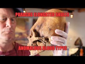 Paracas Elongated Skulls: They Were Not 100% Native American