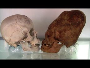 COMING  THE LARGEST DNA EVIDENCE OF ELONGATED SKULLS FROM PERU